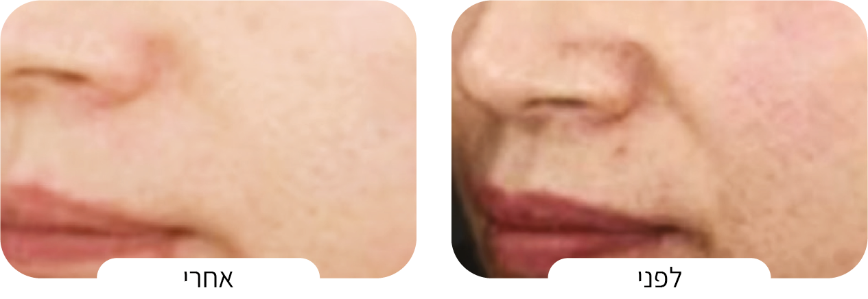 טיפול בגוון העור